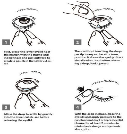 How to use eye drops properly?